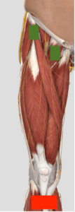 Muscle illustration showing pads placed on Hip Flexors