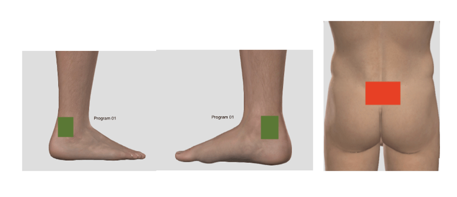 ABMMA PRO Device pads