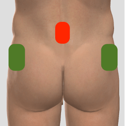 Image showing ABMMA PRO pads on lateral glutes and lumbar spine.