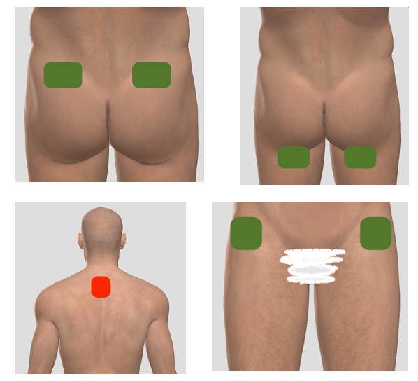 Image showing ABMMA PRO placements on the body